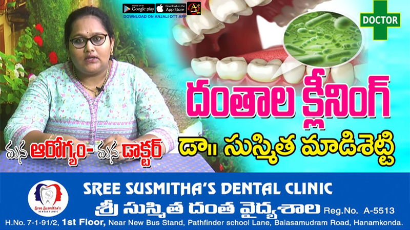 Dental Cleaning | Dental Scaling | Susmitha Dental